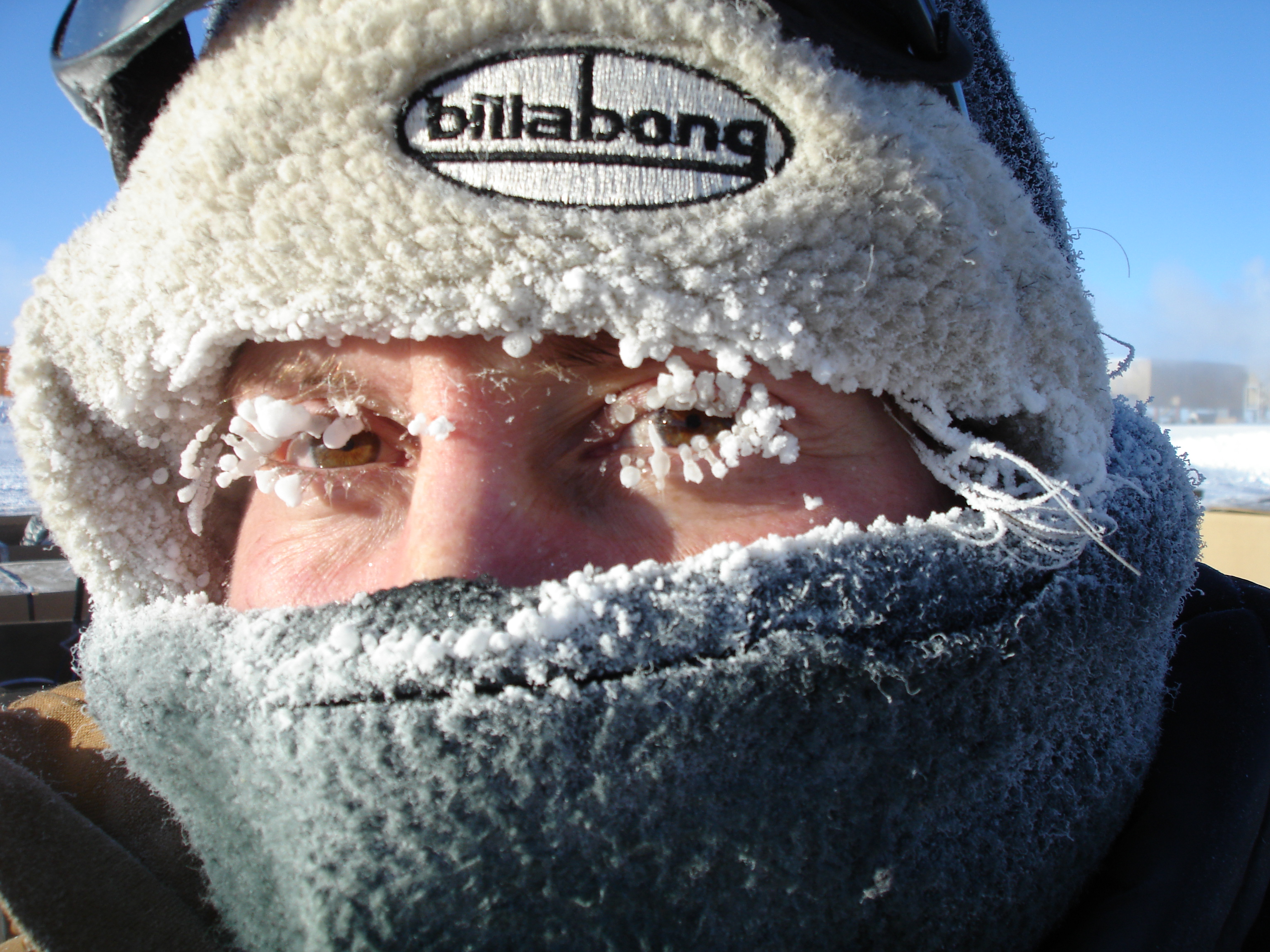 A person with a frost covered face.